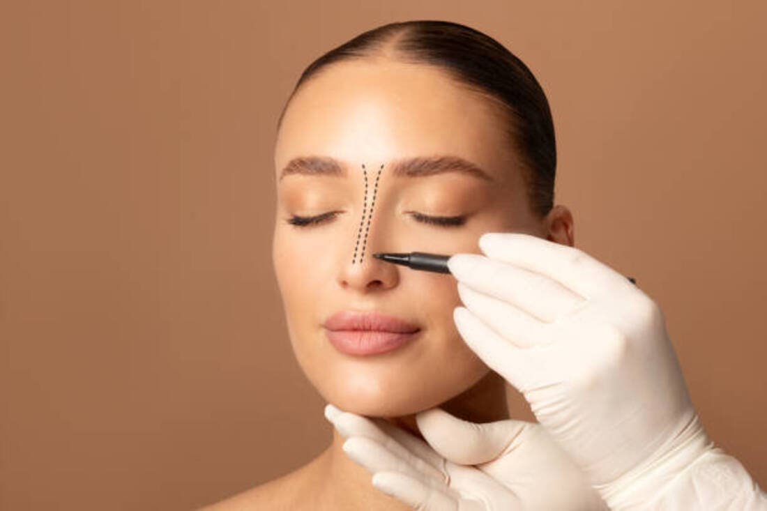 Cirugía plástica y deporte: ¿cuándo puedo retomar el ejercicio después de una rinoplastia?